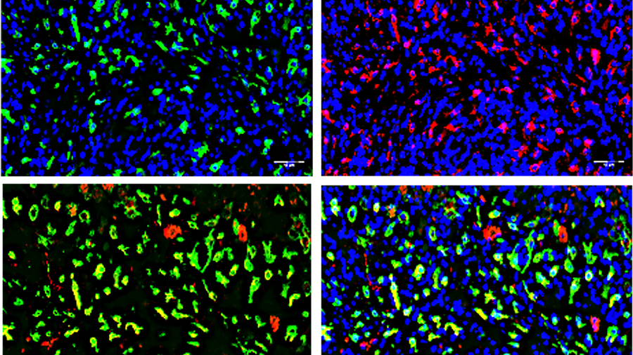 Microscopy of different immune cells in frozen and fixed brain tissue sections.